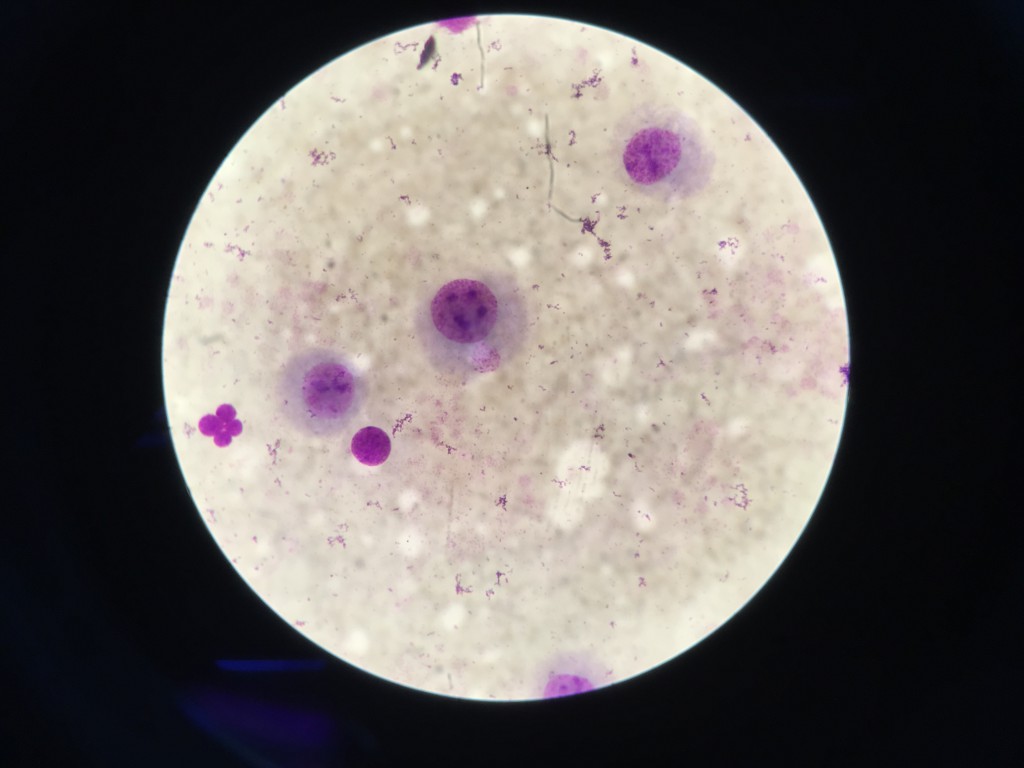 淋巴微核细胞