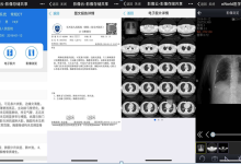 推行“无胶片化”,长兴县建成区域影像云平台-HIT专家网
