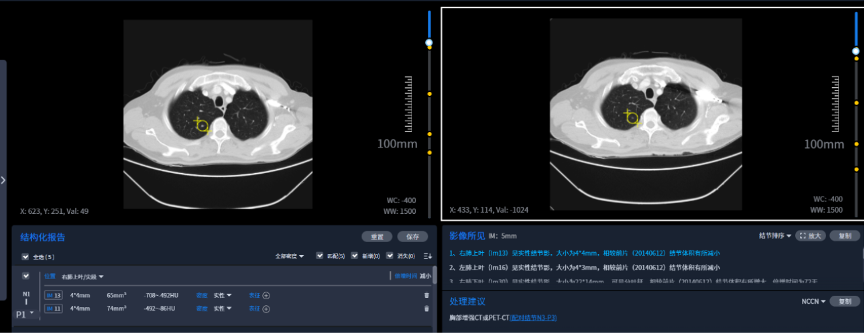 医疗AI助力佛山市第一人民医院智慧战疫